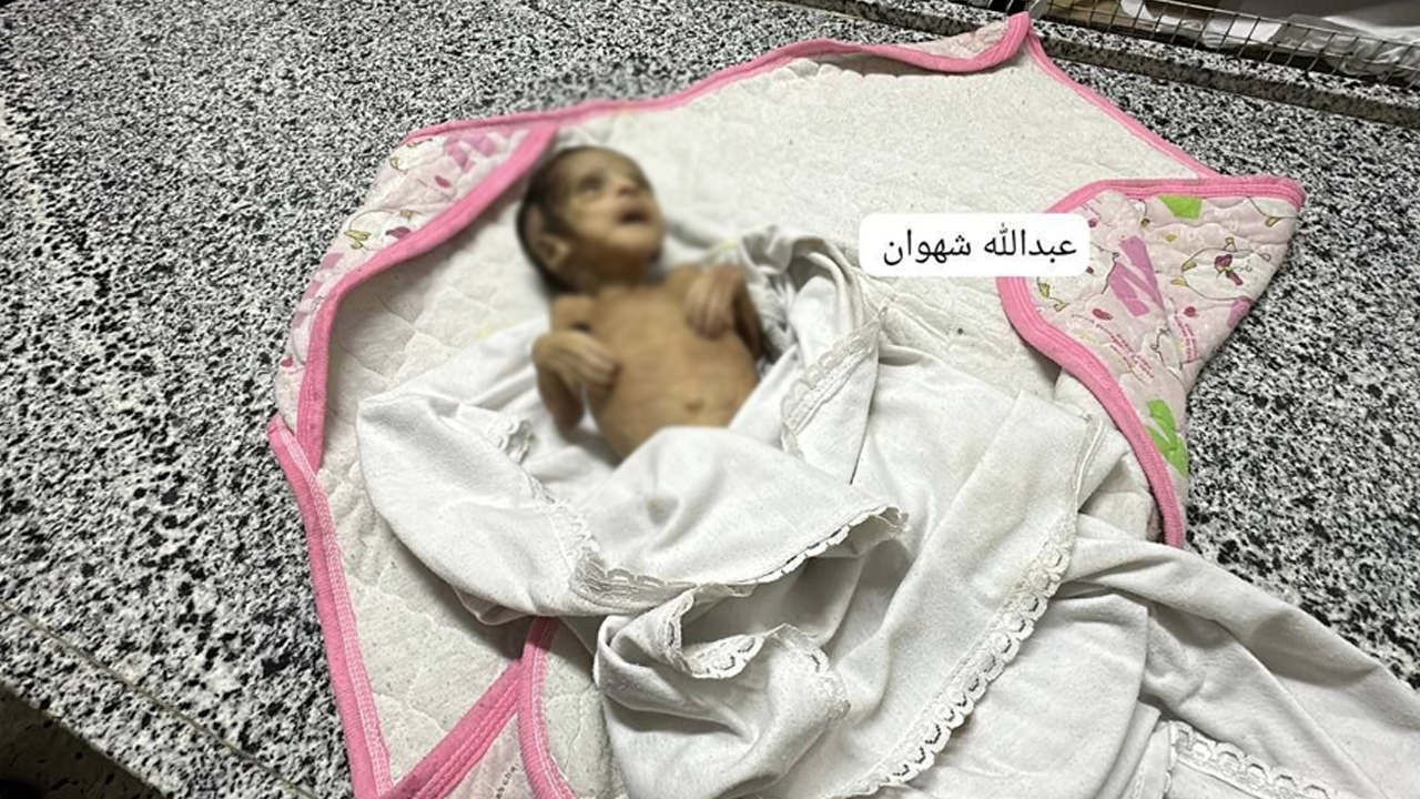 İslam aleminin haysiyeti yerlerde... Gazze'de 3 aylık bir bebek açlıktan öldü!