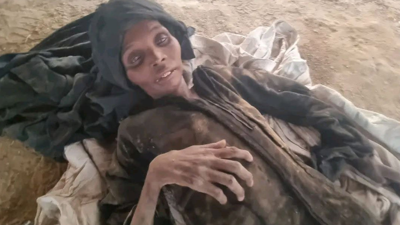 İslam aleminin unuttuğu Yemen'de insanlar açlıktan ölüyor!