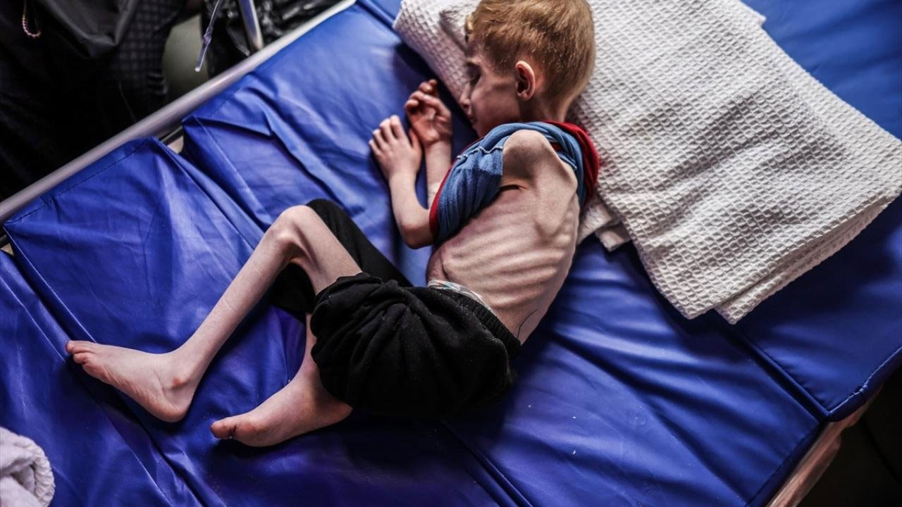 İslam dünyası bunun hesabını ahirette nasıl verecek!.. Gazze’de açlıktan ölen çocuk sayısı 66’ya yükseldi