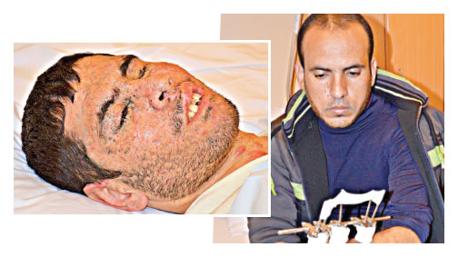 israil dünyalarını kararttı