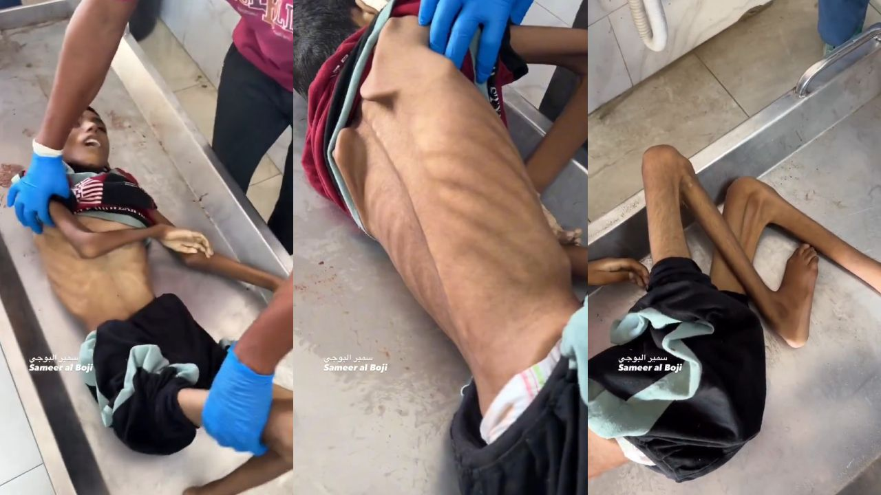 İsrail Gazze'de 12 yaşında bir çocuğu açlıktan öldürdü!