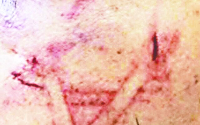 İsrail polisinden Nazi uygulaması