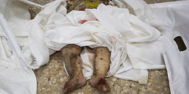 İsrail saldırısında Gazzeli bebeğin kafası koptu!