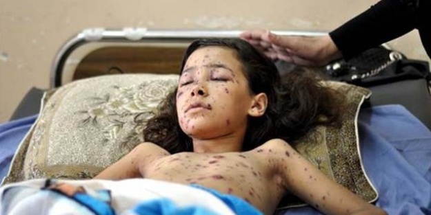 İsrail saldırısından sonra gözlerini açamadı