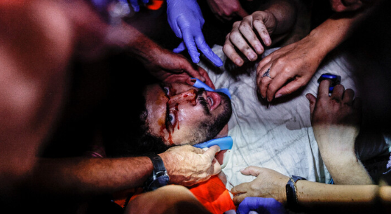 İsrail'de polis göstericilere orantısız şiddet uyguladı