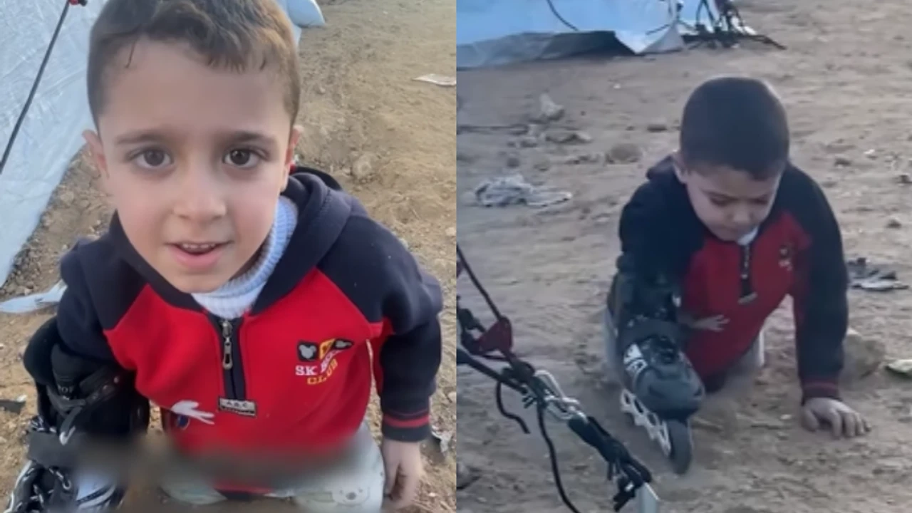İsrail'in bacaklarını kopardığı Gazzeli çocuk böyle yürümeye çalışıyor