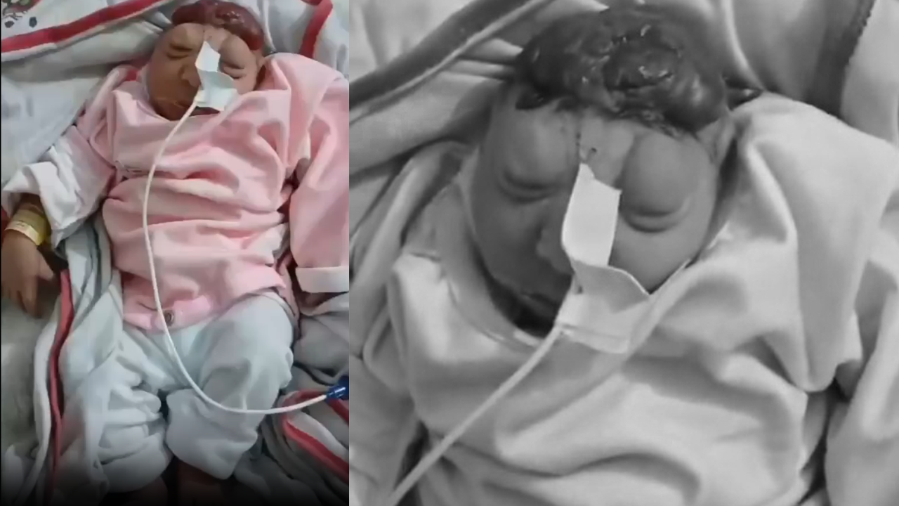 İsrail'in kimyasal faciası: Gazze'de sakat doğumlar görülmeye başlandı!