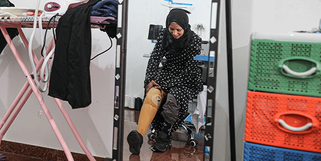 İsrail'in saldırılarında bacağını kaybetti! Filistinli kadından hayat mücadelesi