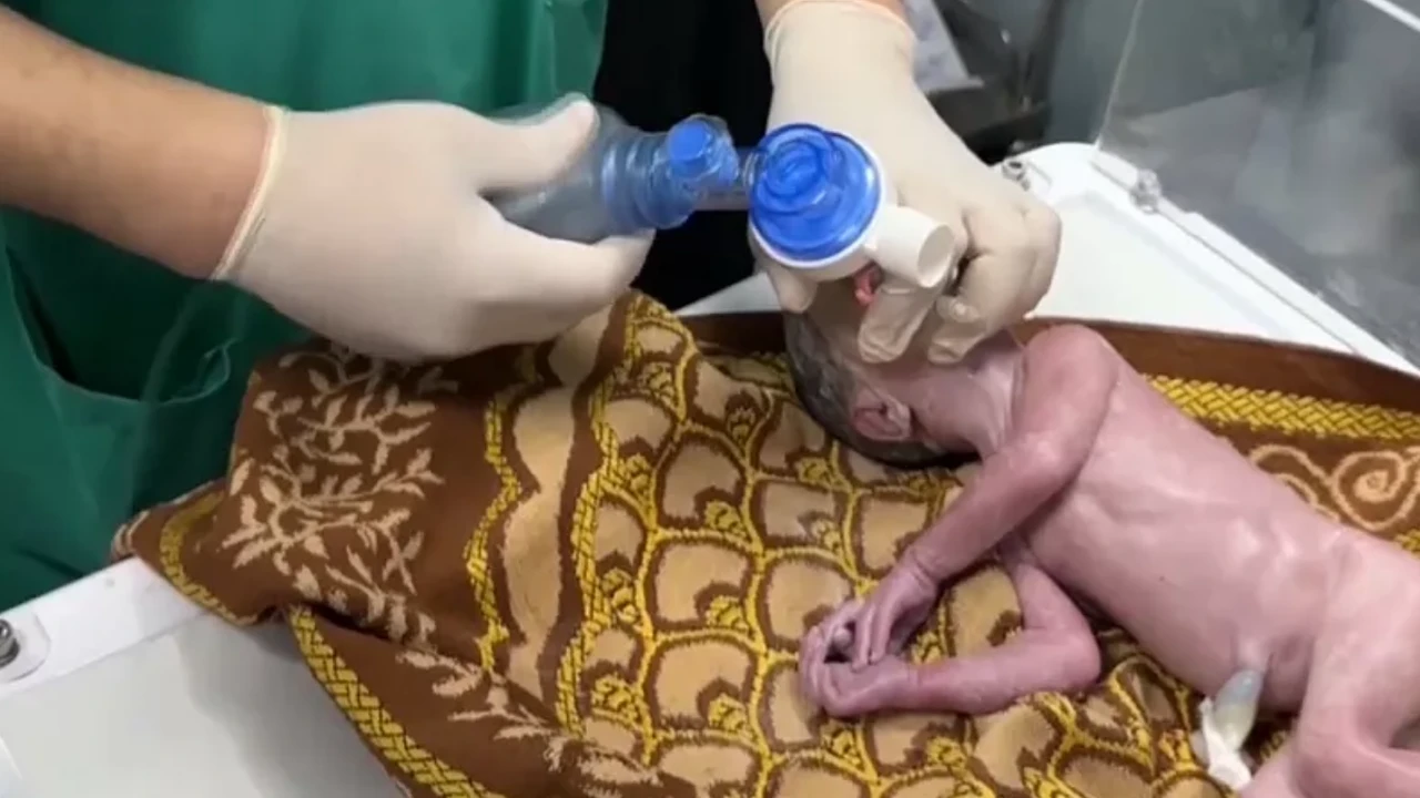 İsrail'in yaraladığı 8 aylık hamile kadının karnındaki bebeği...