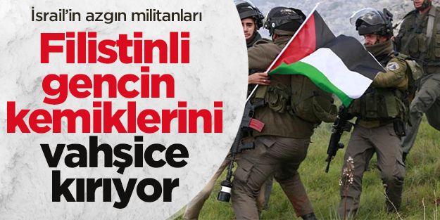 Zalim İsrailliler Filistinli gencin kemiklerini böyle kırdılar!