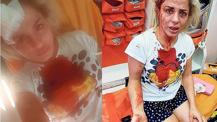 İstanbul Esenyurt’ta taciz etti, dövdü!