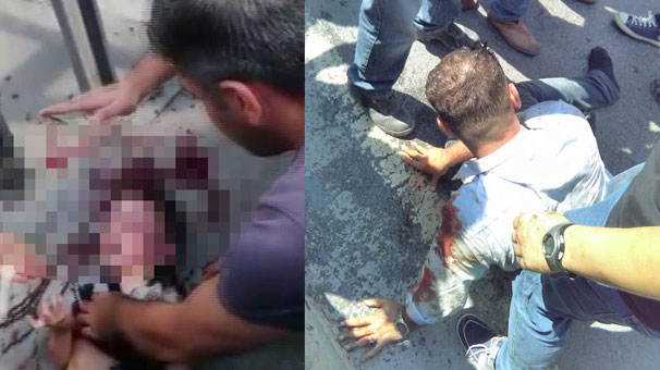 İstanbul Esenyurt'taki dehşet anları: Küçük çocuk beyin kanaması geçirmiş