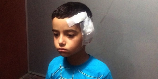 İstanbul Fatih'te maymun dehşeti