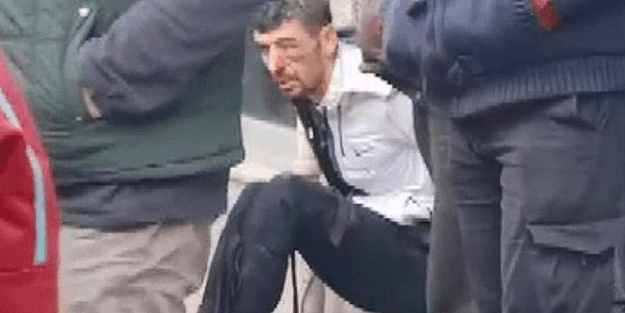 İstanbul'da hırsızlara meydan dayağı! Sonunda hastaneye kaldırıldılar