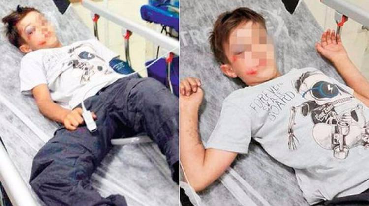 İstanbul'da vahşet!...Kendisine çarptı diye betona fırlattı
