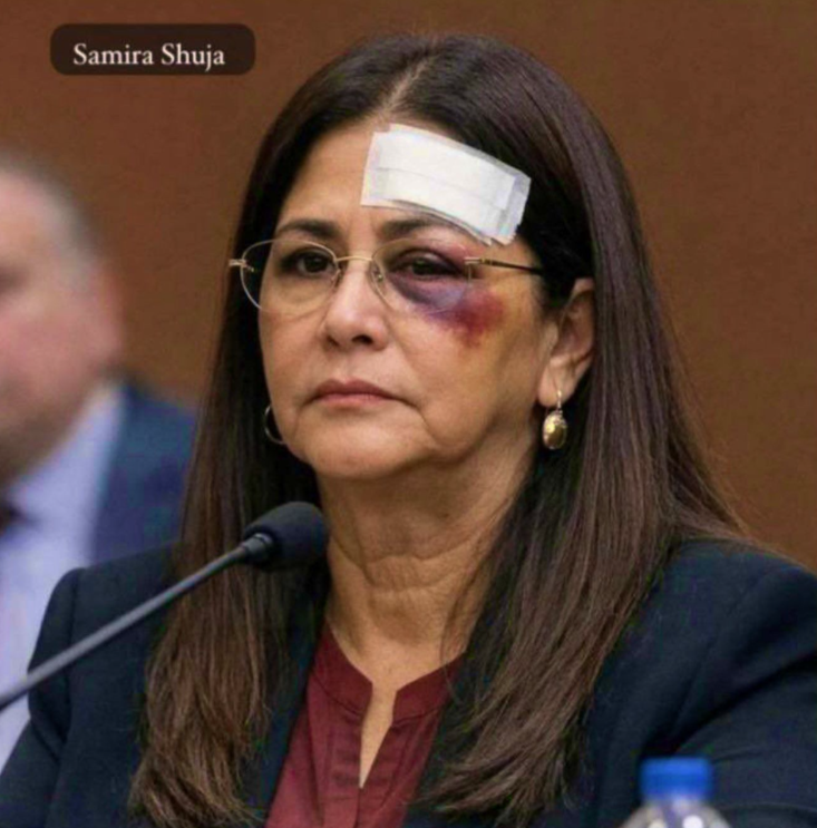 İşte Amerikan demokrasisi! Maduro’nun eşine vahşi darp! "Kaburgasını Kırdılar, Yüzünü Paramparça Ettiler!"