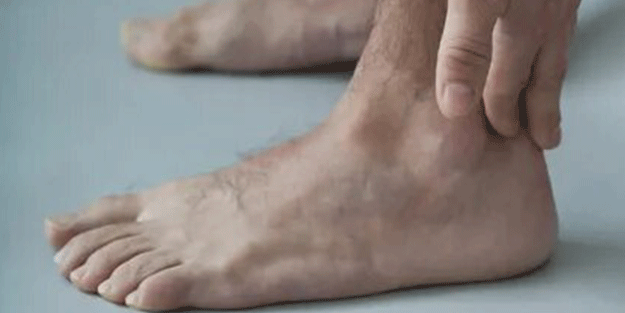 İşte ayak bileği hastalıklarının 7 belirtisi