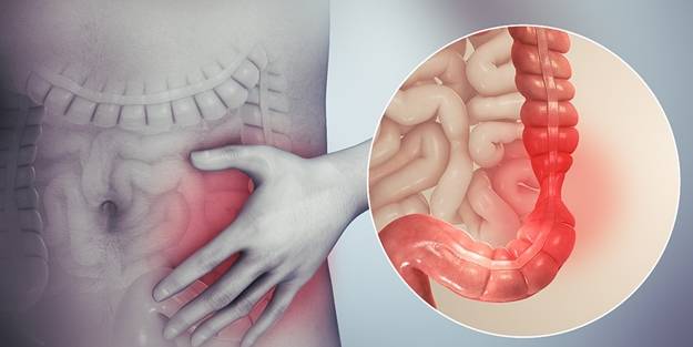İşte bağırsaklarınızın sağlıksız olduğunu gösteren 6 belirti!