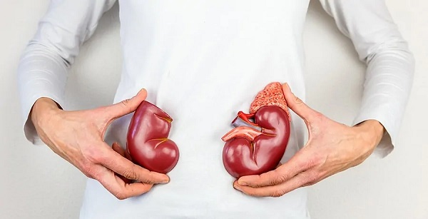 İşte böbrek iltihabının 7 belirtisi