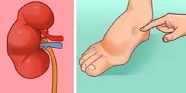 İşte felç geçirmek üzere olduğunuzun 8 işareti