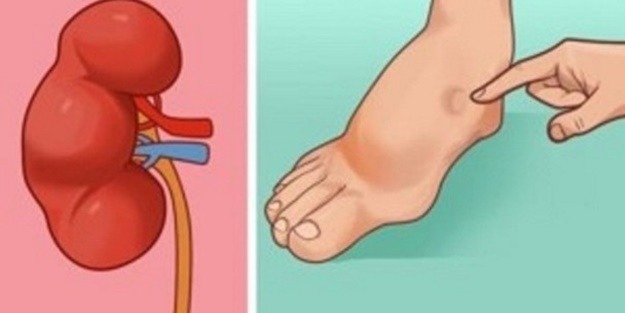 İşte felç geçirmek üzere olduğunuzun 8 işareti!