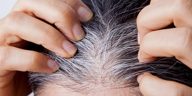 İşte genç yaşta saçları beyazlatan nedenler ve bunları önlemenin yolları