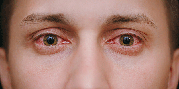 İşte göz sağlığını korumanın 8 yolu