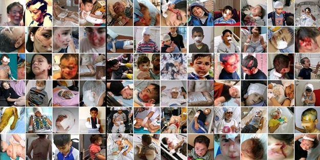 İşte köpek duyarı kasanların ikiyüzlülüğü! Çocuklar ölürken değil uyurken sessiz olunur!