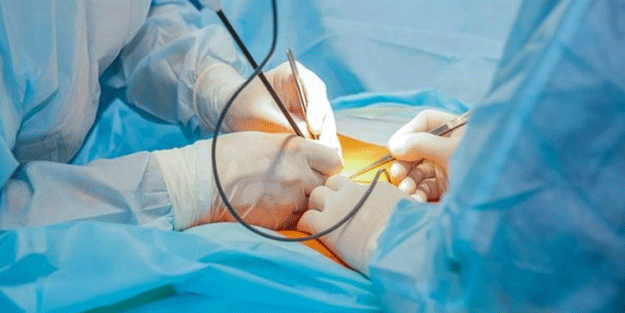 İşte mide ameliyatı ile ilgili her şey