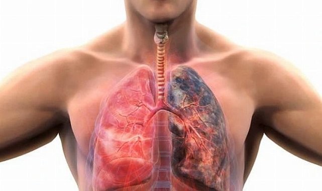 İşte ölüm oranı en hızlı artan hastalık