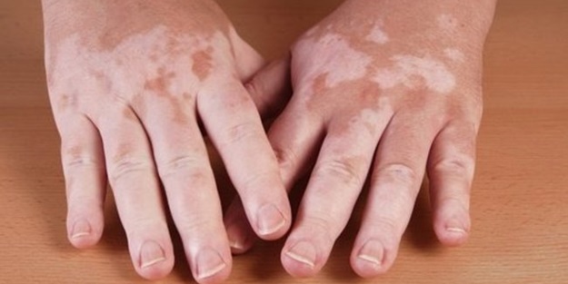 İşte Türkiye'nin en çok merak ettiği hastalıklar