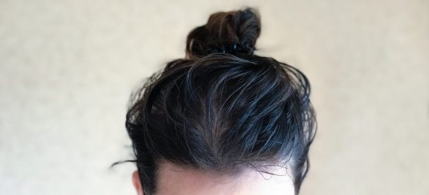 İşte, yağlı saçlara yol açan 5 besin