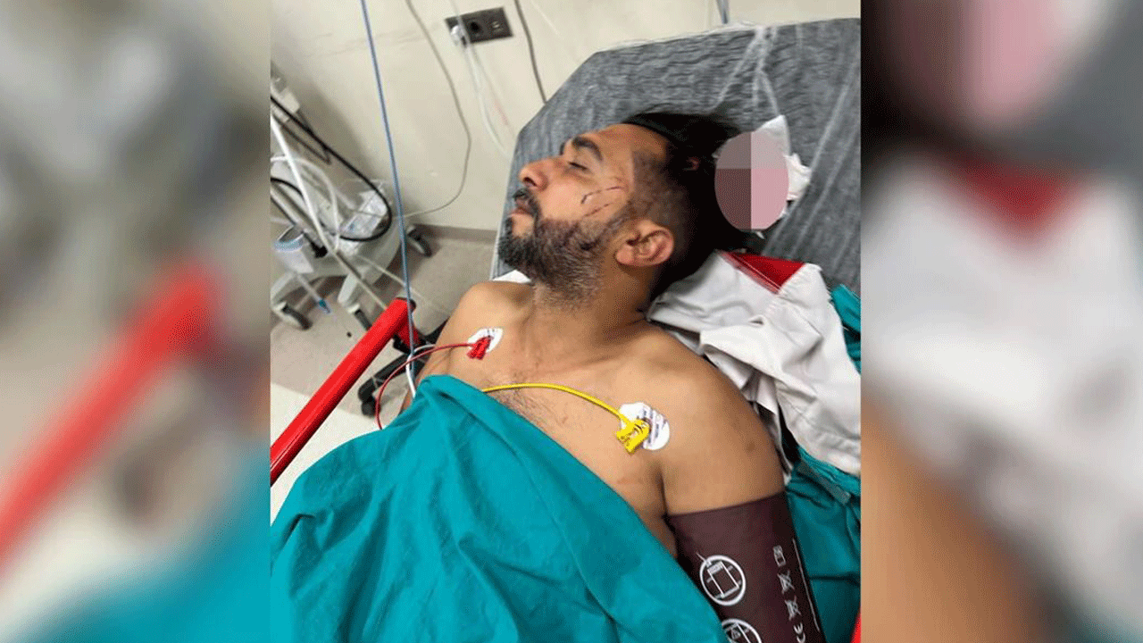 İşyerinin tavanını delen yorgun mermi döner ustasının kafasına saplandı