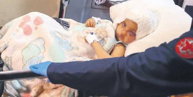 Malum kesimin vicdanları yine sızlamayacak ama... Minik Asiye'den yürekleri dağlayan soru: Anne, yüzüm iyileşecek mi?