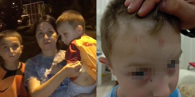 İtperest terörü bitmiyor! 4 yaşındaki çocuk köpek saldırısında...