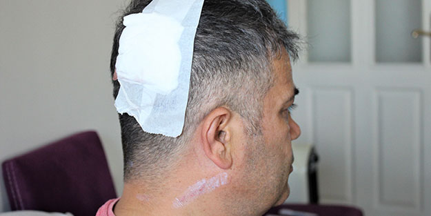 İYİ Partili vekil trafikte saldırıya uğradı