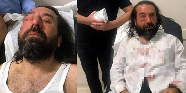 İYİ Parti'nin kurucularından olan isim saldırıya uğradı