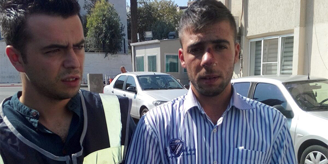 Amatör maçta kan aktı!