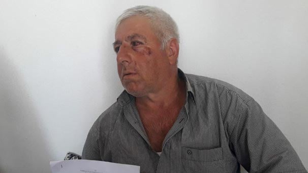İzmir'de kendilerini uyaran engelliyi dövdüler!