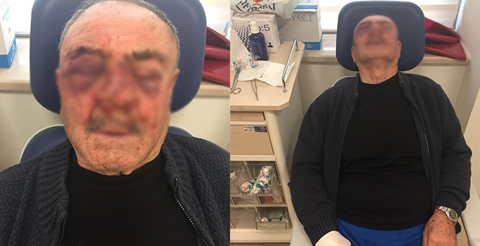 İzmir’de komşusundan aidat istedi hastanelik oldu