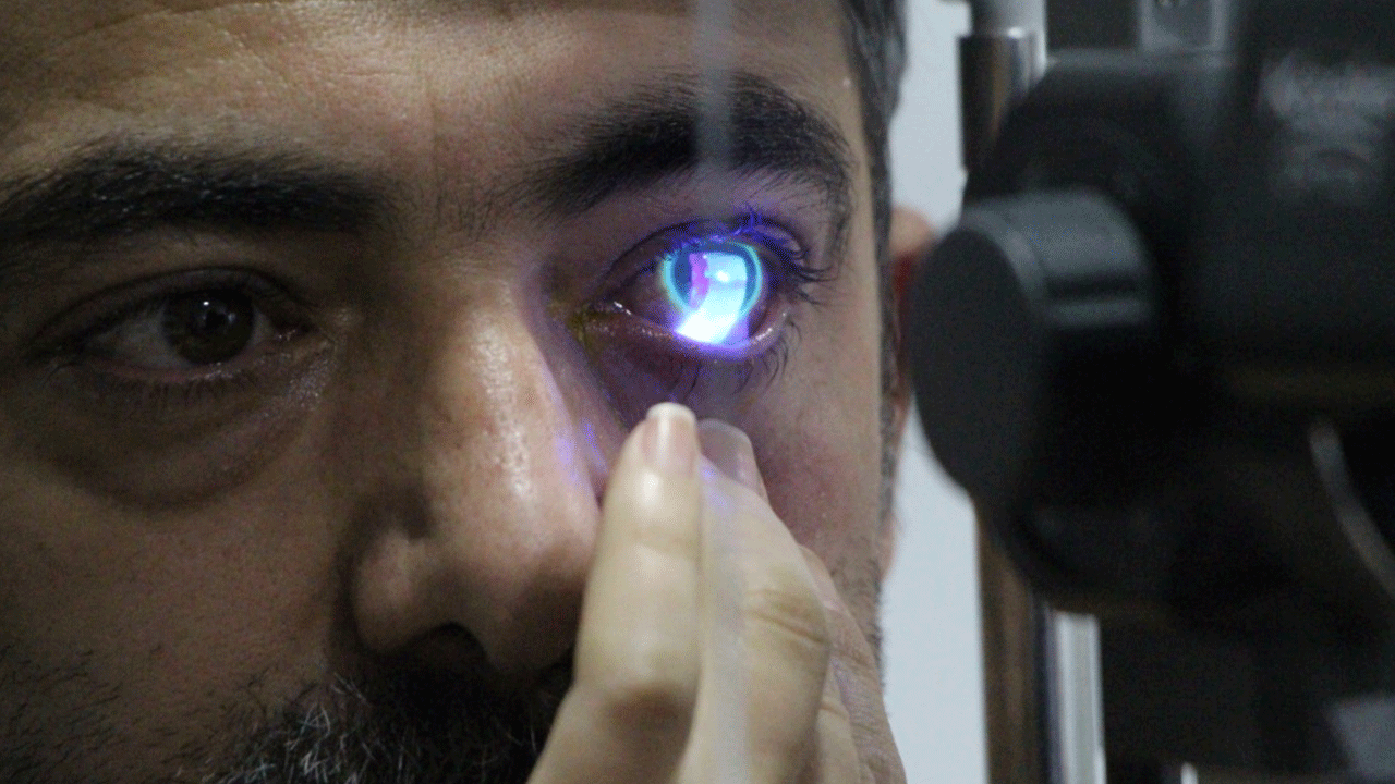 Japon yapıştırıcı gözüne kaçtı hastanelik oldu!