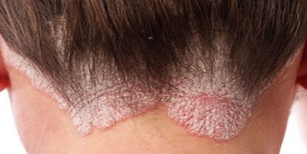 Jöle kullananlar dikkat!