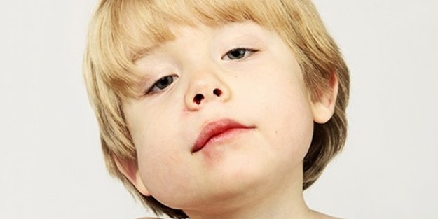 Kabakulağın tek çaresi...