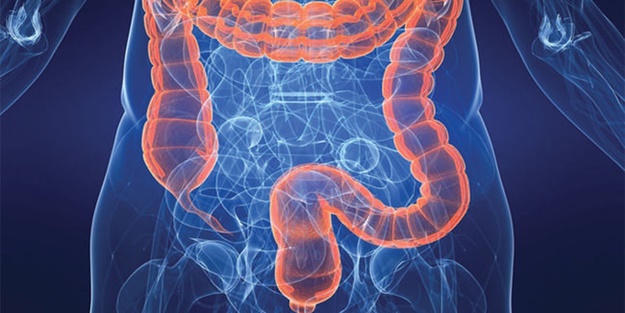 Kabızlık için kür | Kabızlık nasıl geçer bitkisel çözüm