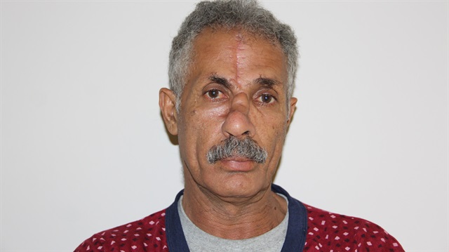 Kaburgasından burun yapıldı!