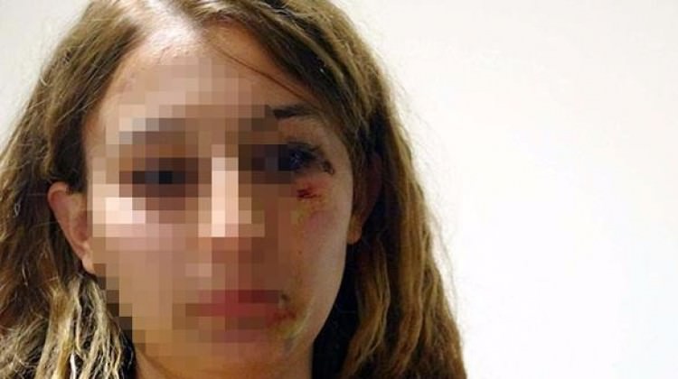 Kuaför kadın polisi feci şekilde dövdü!