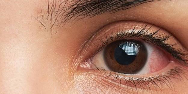 Kadın ve erkeklerde görülme oranı aynı