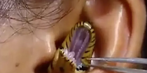 Kadının kulağına yılan kaçtı! Mide bulandıran görüntü sosyal medyayı ikiye böldü