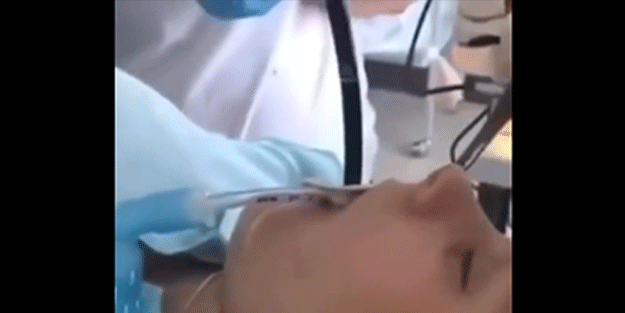 Kadının midesinden çıkan 1 metrelik yılanın gizemi çözüldü! İnanılır gibi değil