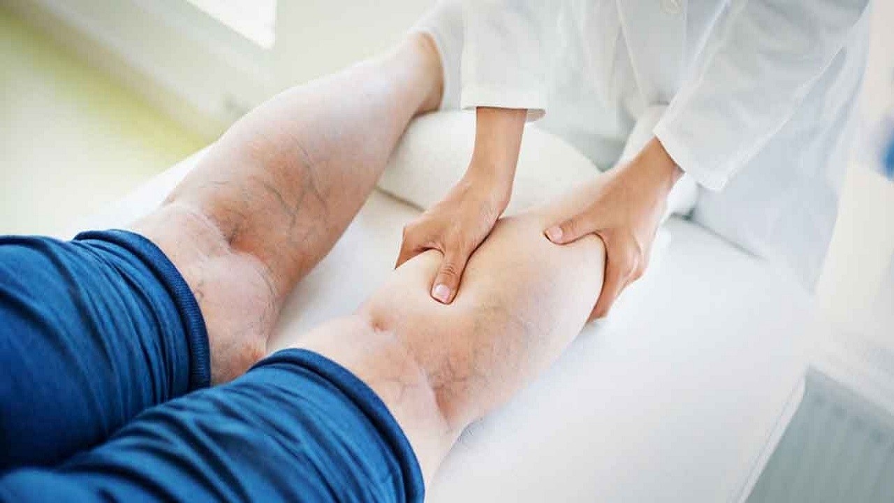 Kadınların gizli düşmanı: Lipödem